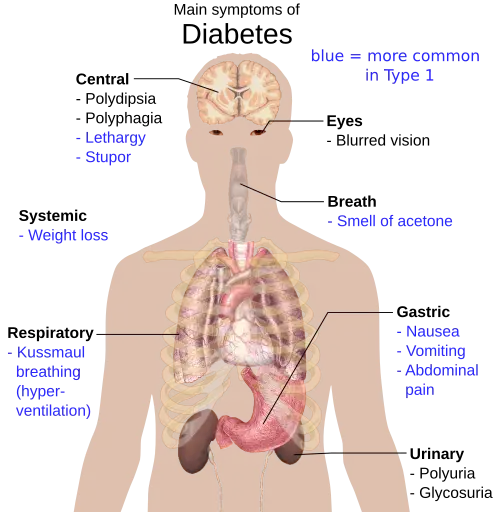 Main symptoms of Type 2 Diabetes

