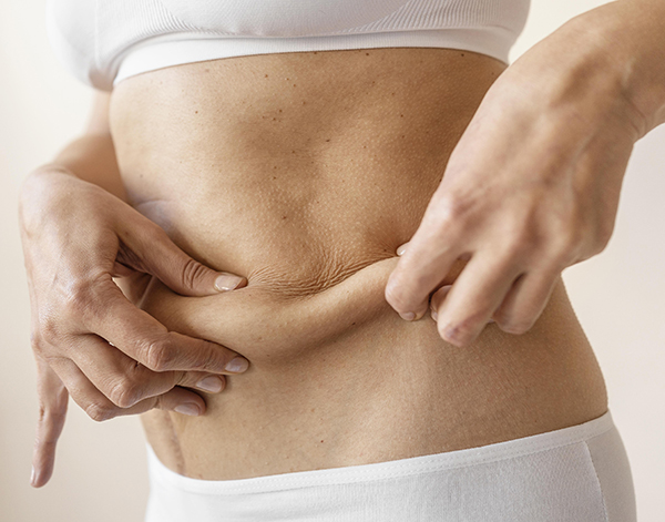 Mesotherapy for the elimination of localized fat